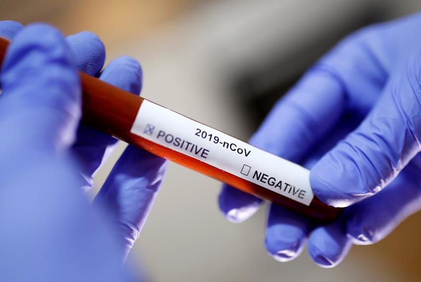 A glitch in mass produced COVID-19 testing kits  has limited the supply of available tests.
https://www.texastribune.org/2020/03/05/texas-coronavirus-response-what-state-officials-can-do/